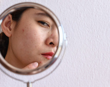 What makes skin inflammation become bugs?