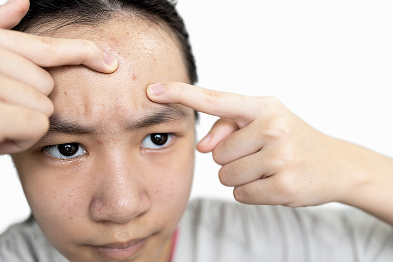 Little pimples, white heads, what makes them and how oversee them to make your face clear as in the past