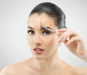 Acne on the eyebrows is caused by what? Let's find out the answer and how to fix it