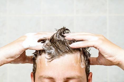 7 ways to prevent premature baldness